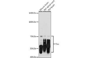 Western blot analysis of extracts of various cell lines, using Tau antibody (ABIN3021441, ABIN3021442, ABIN3021443 and ABIN6215045) at 1:500 dilution. (MAPT 抗体  (AA 1-100))