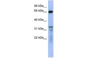 WB Suggested Anti-RAP1GAP Antibody Titration: 0. (RAP1GAP 抗体  (Middle Region))