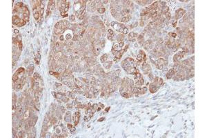 IHC-P Image Immunohistochemical analysis of paraffin-embedded SW480 xenograft, using HPS3, antibody at 1:500 dilution. (HPS3 抗体  (C-Term))