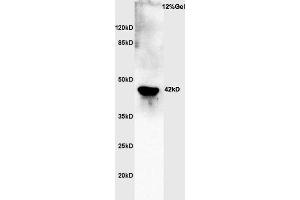 Rat brain lysates probed with Rabbit Anti-Actin Polyclonal Antibody, Unconjugated  at 1:3000 for 90 min at 37˚C. (Actin 抗体  (AA 165-260))