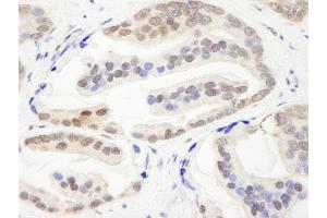anti-Chromodomain Helicase DNA Binding Protein 3 (CHD3) (AA 1950-2000) antibody
