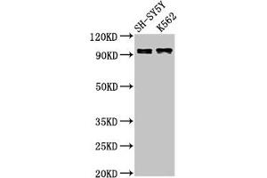 Western Blot Positive WB detected in: SH-SY5Y whole cell lysate, K562 whole cell lysate All lanes: KCNQ3 antibody at 3 μg/mL Secondary Goat polyclonal to rabbit IgG at 1/50000 dilution Predicted band size: 97, 85 kDa Observed band size: 97 kDa (KCNQ3 抗体  (AA 763-872))