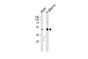 Western Blotting (WB) image for anti-Clusterin (CLU) (AA 71-99), (N-Term) antibody (ABIN654897)
