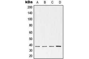 Western blot analysis of cTnT expression in H9 (A), 4T1 (B), human heart (C) whole cell lysates. (Cardiac Troponin T2 抗体  (Center))