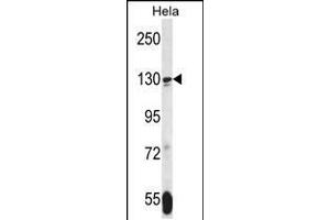 Western blot analysis in Hela cell line lysates (35ug/lane). (TNKS 抗体  (N-Term))