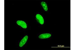 Immunofluorescence of monoclonal antibody to MAGED2 on HeLa cell. (MAGED2 抗体  (AA 16-125))