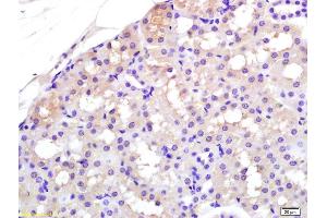 Formalin-fixed and paraffin embedded rat kidney labeled with Rabbit Anti APAF1(NT) Polyclonal Antibody, Unconjugated (ABIN724310) at 1:200 followed by conjugation to the secondary antibody and DAB staining