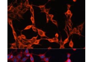Immunofluorescence analysis of NIH/3T3 cells using SLC25A23 Polyclonal Antibody at dilution of 1:100.