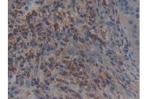 Immunohistochemistry (IHC) image for anti-Adenylyl Cyclase Associated Protein 2 (CAP2) (AA 1-477) antibody (ABIN7443644)