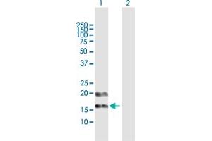 Western Blot analysis of PFDN4 expression in transfected 293T cell line by PFDN4 MaxPab polyclonal antibody. (PFDN4 抗体  (AA 1-134))