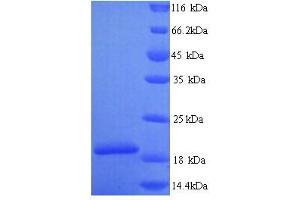 SDS-PAGE (SDS) image for Group XIIA Secretory Phospholipase A2 (PG12A) (AA 23-185), (partial) protein (His tag) (ABIN5714468)