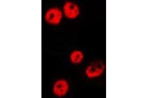 ABIN6275487 staining HepG2 by IF/ICC. (RBBP5 抗体  (Internal Region))