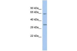 WB Suggested Anti-MIF4GD Antibody Titration:  0. (MIF4GD 抗体  (N-Term))