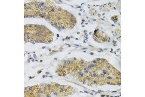Immunohistochemistry (IHC) image for anti-Protein tyrosine Phosphatase, Receptor Type, A (PTPRA) (AA 20-142) antibody (ABIN1682399)