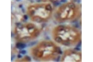 Used in DAB staining on fromalin fixed paraffin-embedded Kidney tissue (Laminin alpha 1 抗体  (AA 886-1039))