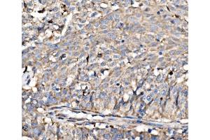 IHC analysis of RPL17 using anti-RPL17 antibody (ABIN7601639). (RPL17 抗体  (AA 40-167))