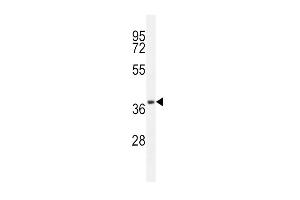 Western Blotting (WB) image for anti-CD14 (CD14) (AA 54-83), (N-Term) antibody (ABIN5535578)