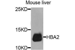 Western blot analysis of extracts of mouse liver, using HBA2 antibody. (HBa2 抗体  (AA 1-142))