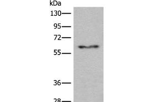 Western blot analysis of Human fetal liver tissue lysate using CES2 Polyclonal Antibody at dilution of 1:600 (CES2 抗体)