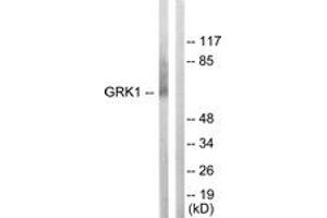 Western blot analysis of extracts from COLO205 cells, using GRK1 (Ab-21) Antibody. (GRK1 抗体  (AA 6-55))