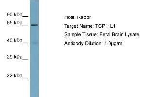 Host: Rabbit Target Name: TCP11L1 Sample Type: Fetal Brain lysates Antibody Dilution: 1. (TCP11L1 抗体  (C-Term))