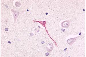 Anti-GPR17 antibody  ABIN1048752 IHC staining of human brain, neurons and glia. (GPR17 抗体  (N-Term))