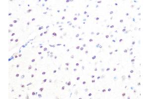 Immunohistochemistry (IHC) image for anti-MAD2 Mitotic Arrest Deficient-Like 2 (MAD2L2) antibody (ABIN1679325)