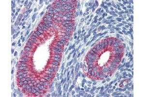 Human uterus; Anti-ZNF71 antibody IHC staining of human uterus. (ZNF71 抗体)