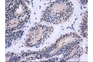 Image no. 8 for anti-Nonhomologous End-Joining Factor 1 (NHEJ1) antibody (ABIN1499729) (NHEJ1 抗体)