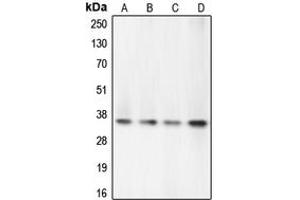 Western blot analysis of Caspase 7 expression in PC12 (A), Jurkat (B), HeLa (C), HEK293T (D) whole cell lysates.