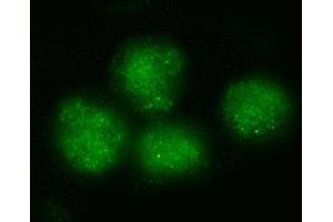 IF analysis of BRD4 using anti-BRD4 antibody (ABIN7602518).