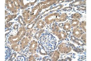 SLC16A8 antibody was used for immunohistochemistry at a concentration of 4-8 ug/ml to stain Epithelial cells of renal tubule (arrows) in Human Kidney. (MCT3 抗体)