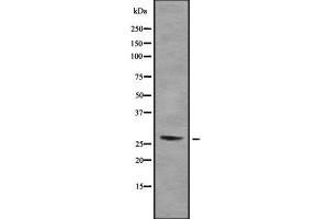 Western blot analysis of RPA30 using COLO205 whole cell lysates (RPA4 抗体  (Internal Region))