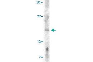 Western blot analysis of IFNB1 in A-20 cell lysate with IFNB1 polyclonal antibody  at 5 ug/mL . (IFNB1 抗体  (Internal Region))