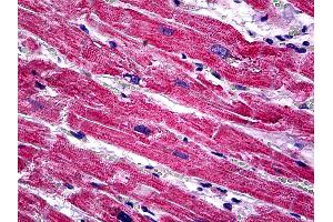 Immunohistochemistry (IHC) image for anti-Sprouty Homolog 1, Antagonist of FGF Signaling (SPRY1) (AA 1-111) antibody (ABIN626082)