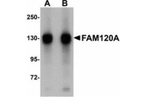 Image no. 1 for anti-Family with Sequence Similarity 120A (FAM120A) (Internal Region) antibody (ABIN478146)
