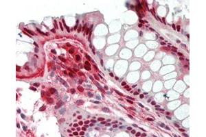 Immunohistochemistry (IHC) image for anti-Nicotinamide phosphoribosyltransferase (NAMPT) antibody (Biotin) (ABIN1169029)