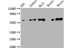 Western Blot Positive WB detected in: 293 whole cell lysate, Jurkat whole cell lysate, Raji whole cell lysate, Mouse brain tissue, Rat brain tissue All lanes: PAK2 antibody at 1:2000 Secondary Goat polyclonal to rabbit IgG at 1/50000 dilution Predicted band size: 59 kDa Observed band size: 59 kDa (Recombinant PAK2 抗体)