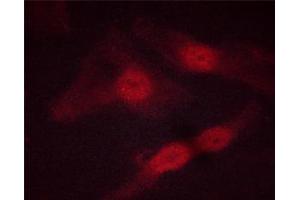 ABIN6267513 staining HeLa cells by ICC/IF. (STAT5 A/B 抗体  (pSer725, pSer730))