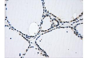 Immunohistochemical staining of paraffin-embedded pancreas tissue using anti-GBE1 mouse monoclonal antibody. (GBE1 抗体)