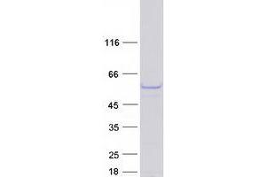 Western Blotting (WB) image for PAXIP1 Associated Glutamate-Rich Protein 1 (PAGR1) protein (Myc-DYKDDDDK Tag) (ABIN2728096)