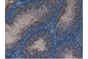 IHC-P analysis of Mouse Testis Tissue, with DAB staining. (Lactoferrin 抗体  (AA 63-193))