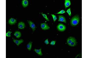 Immunofluorescence staining of A549 cells with ABIN7166791 at 1:100, counter-stained with DAPI. (FKSG2 抗体  (AA 1-139))