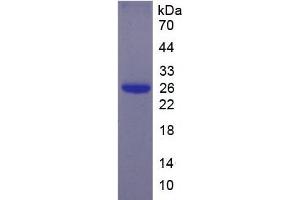 SDS-PAGE analysis of Human EBI3 Protein. (EBI3 蛋白)