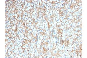 Immunohistochemistry (IHC) image for anti-CD274 (PD-L1) (AA 39-191) antibody (ABIN6939571)