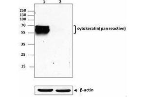 Western Blotting (WB) image for anti-Keratin 1 (KRT1) antibody (ABIN2664915) (Cytokeratin 1 抗体)