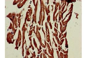 Immunohistochemistry of paraffin-embedded human heart tissue using ABIN7163262 at dilution of 1:100 (PHOSPHO1 抗体  (AA 1-267))