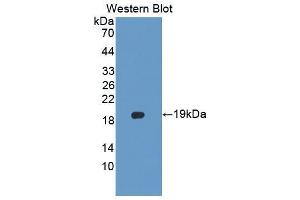 Western blot analysis of the recombinant protein. (PLTP 抗体  (AA 337-479))
