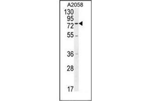 Western blot analysis of ENTHD1 Antibody (N-term) in A2058 cell line lysates (35ug/lane). (ENTHD1 抗体  (N-Term))
