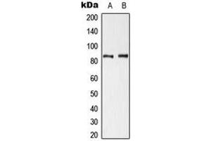 Western blot analysis of Cortactin (pY421) expression in HeLa UV-treated (A), NIH3T3 H2O2-treated (B) whole cell lysates. (Cortactin 抗体  (pTyr421))